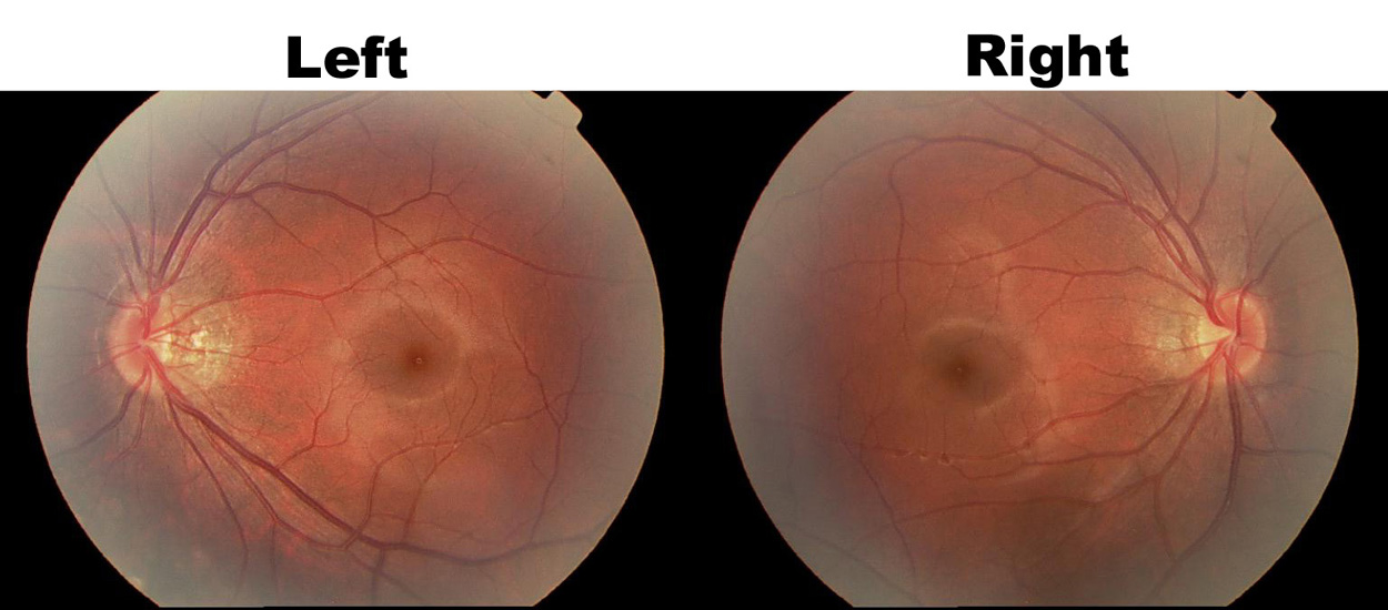 left-right